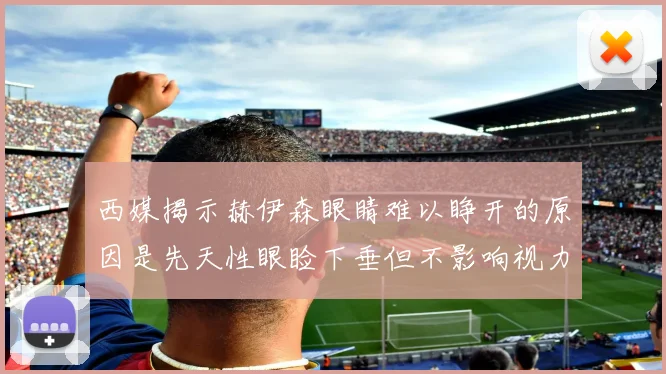 西媒揭示赫伊森眼睛难以睁开的原因是先天性眼睑下垂但不影响视力
